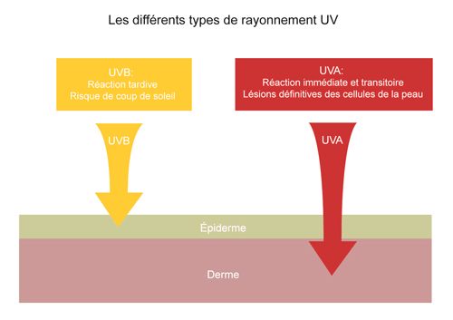 differents-typesUV-1