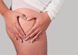 Vergetures : Halte aux idées reçues